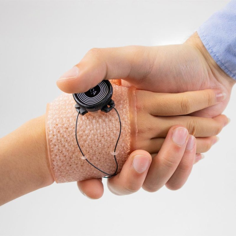 Two hands in an embrace with one hand wearing a healthcare device